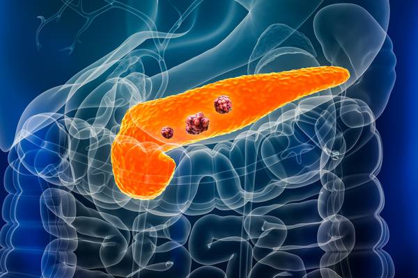 What you need to know about pancreatic cancer